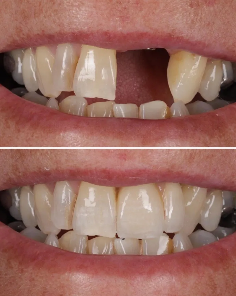 Before & after treatment with Alisdair